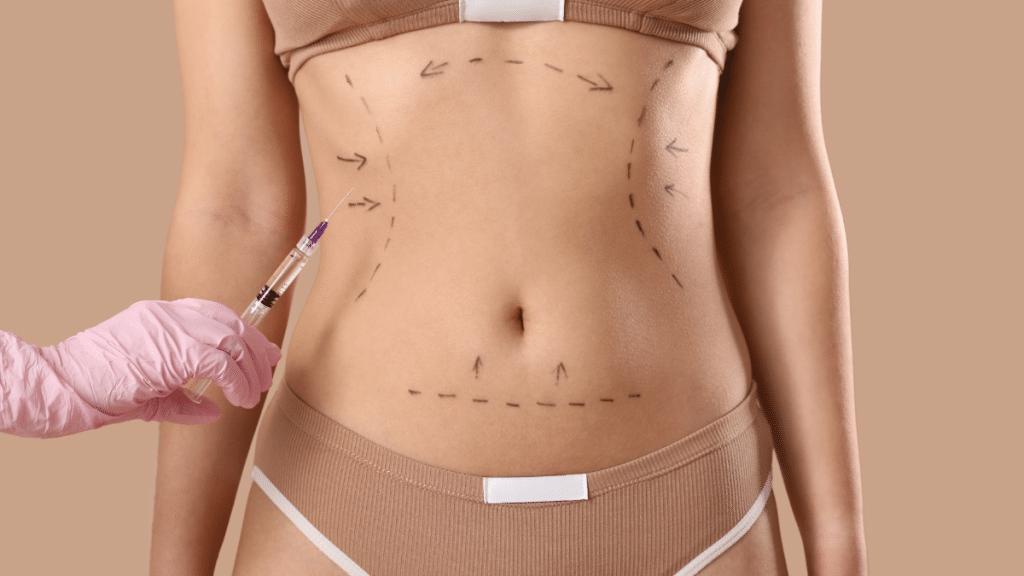Chirurgien plasticien avec injection et marques sur le ventre d'une femme sur fond beige, gros plan