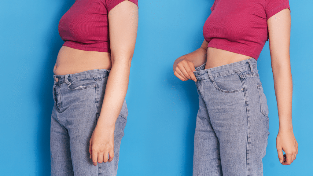 un avant après d'une personne qui a eu recourt à une abdominoplastie
