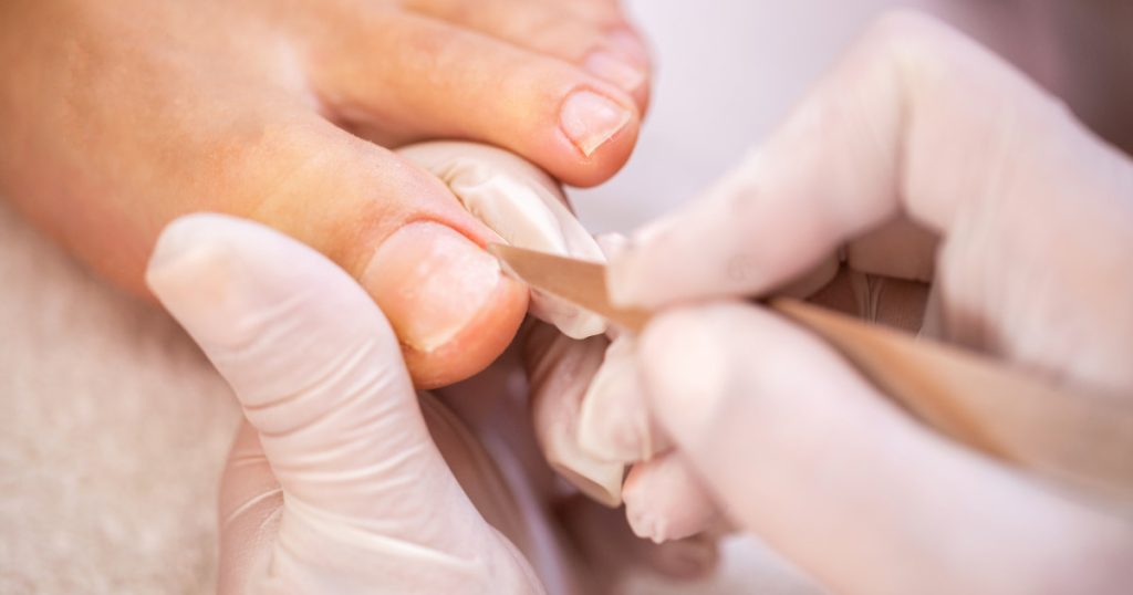 Pédicure en cours avec un outil sur l'ongle et un pied