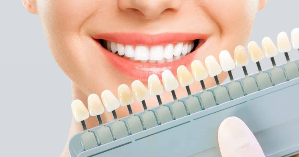 Une femme aux dents blanches sourit en tenant un nuancier dentaire devant son visage. 