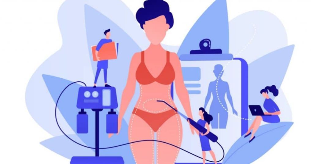 Hoe kom je in aanmerking voor liposuctie? Een grafische voorstelling van liposuctie.