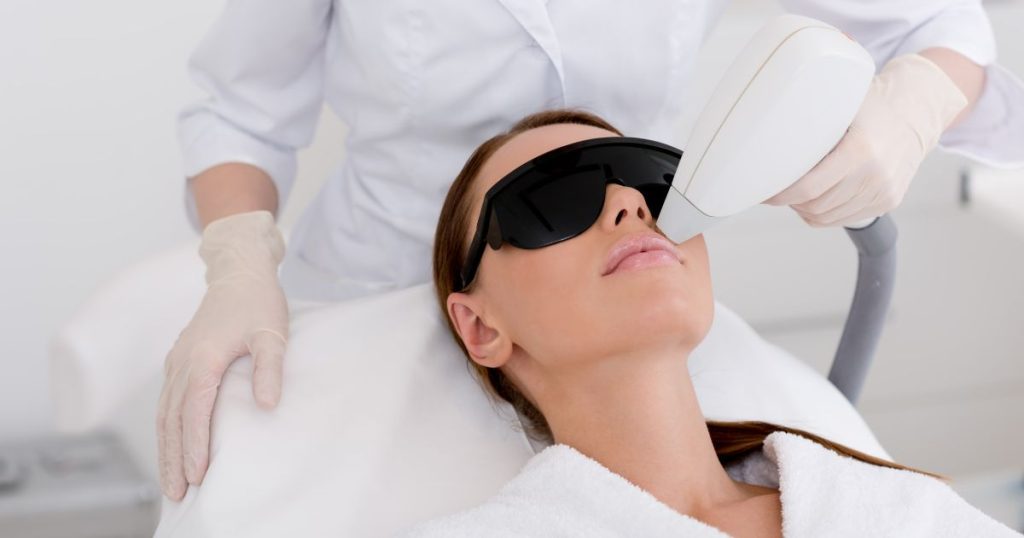 Een dame draagt oogbescherming terwijl een arts of medisch assistente een laseronthaarder richt op het gelaat, tussen de lippen en de neus.
