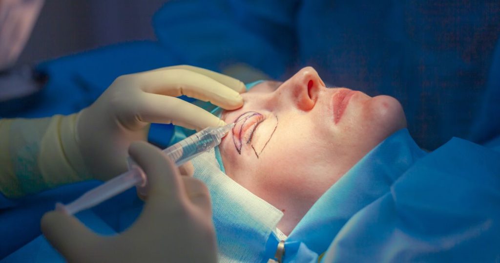 Een dame die een ooglidcorrectie laat uitvoeren op een operatietafel. Een arts met gele handschoenen brengt de plaatselijke verdoving in met een injectiespuit. 