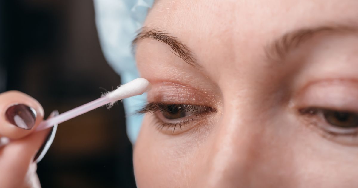 Close-up van de ogen en vingers van een dame die na een ooglidcorrectie haar oogleden ontsmet met een wattenstaafje.